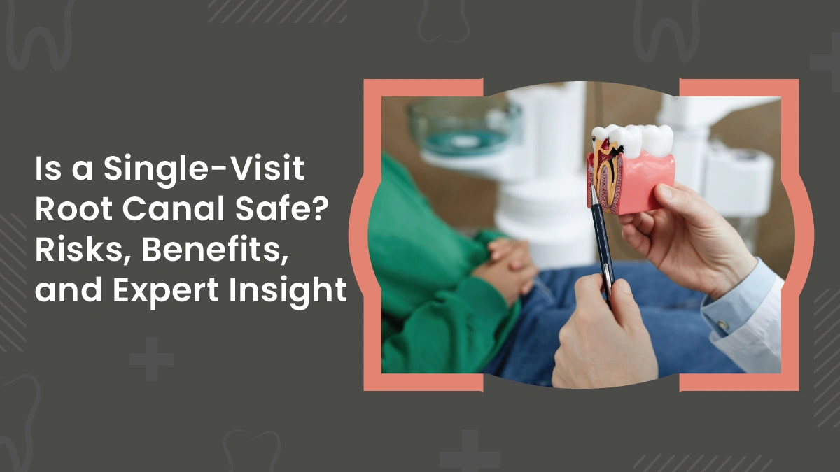 Single-Sitting Root Canal Treatment: Safety, Risks & Benefits